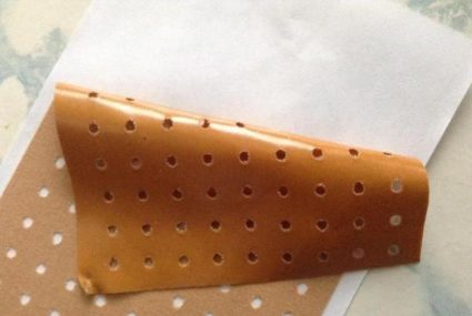 Может возникнуть алергическая реакция Пластырь за счет прогревающих веществ попадает в место воспаления