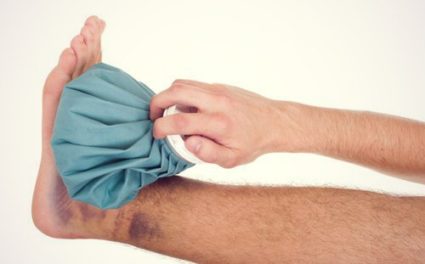 При травме стопы приложите лед Растяжение и переломы нужно приложить холод