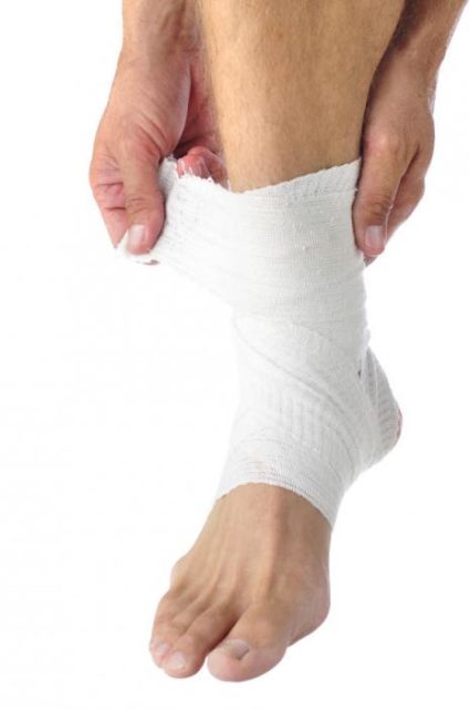 Специальными спицами фиксируют перелом Эластичный бинт