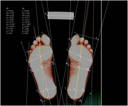 Компьютерная плантография Плантография