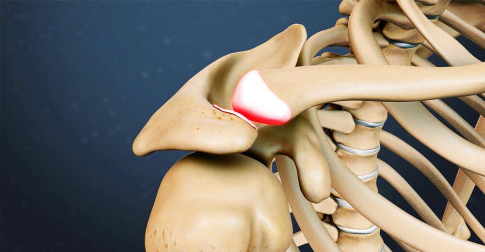 Осложнения