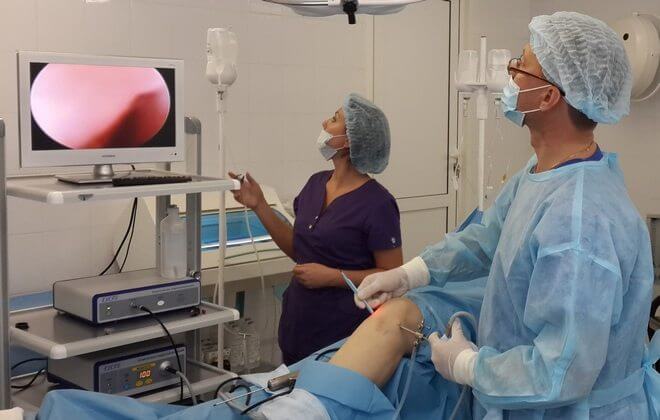 Диагностика артроскопии