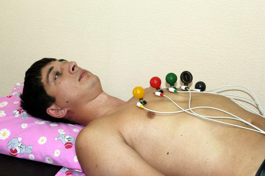 ЭКГ