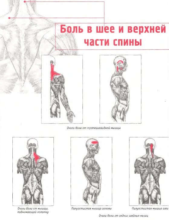Классификация болей в области шеи