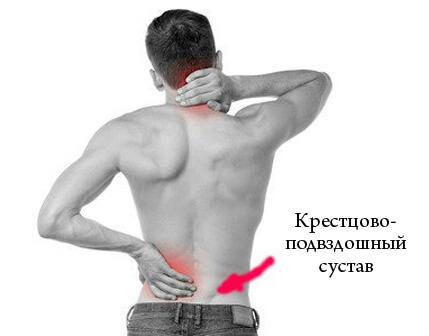 Воспаление крестцово-подвздошного сустава