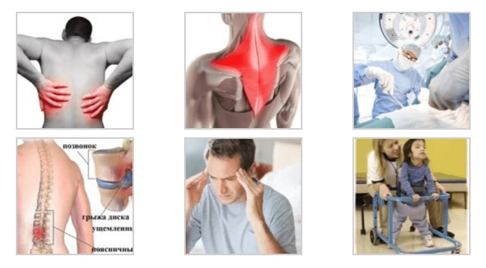 болезни неврологического генезиса