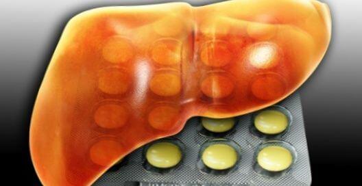 Болезнь печени