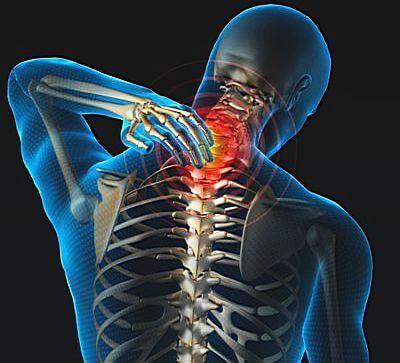 Грыжа в шейном отделе