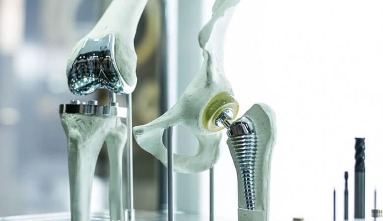 имплантаты