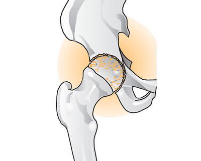 Осложнения