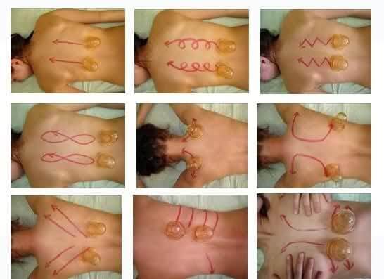 Классический массаж