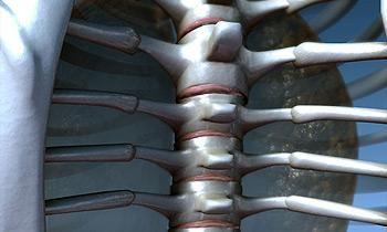 Межреберный