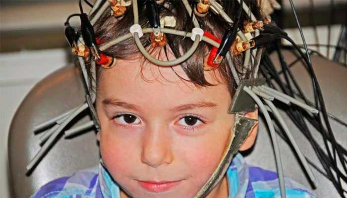 Рэг сосудов головы и шеи