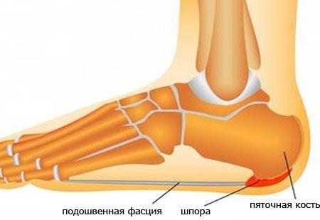 Отличие шпоры от шипици