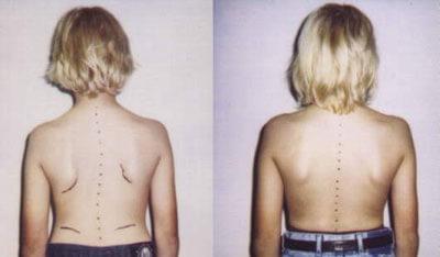 Вторая степень