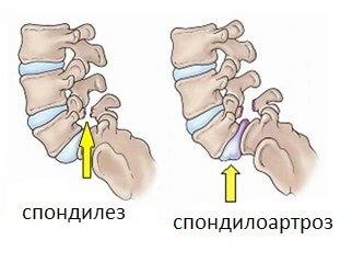 Заболевание