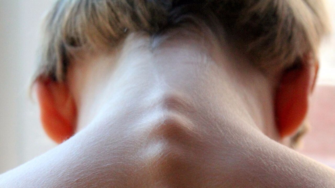 Последняя стадия