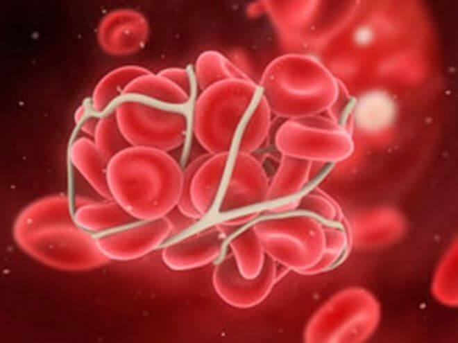 Свертываемость