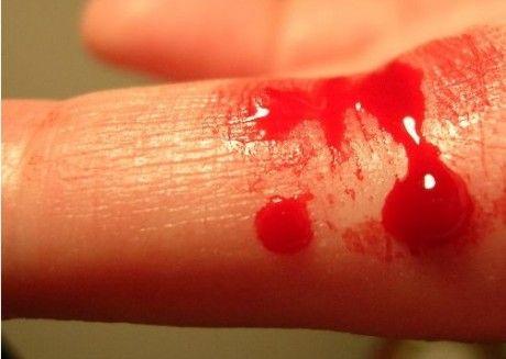 Противопоказания