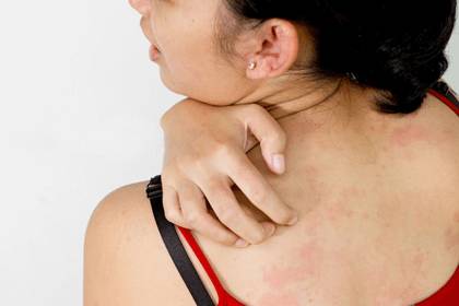 Зуд на коже